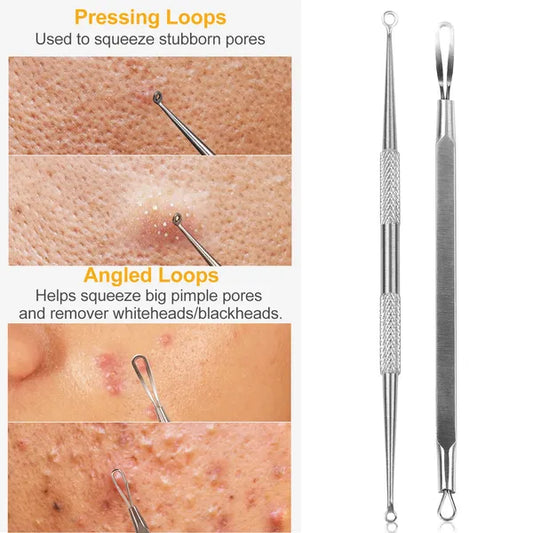 5 Pcs Blackhead Remover Kit Pimple Comedone Extractor Tool Set Stainless Steel ef51ae4c-7244-47f0-8e79-67c4dc7ff84d